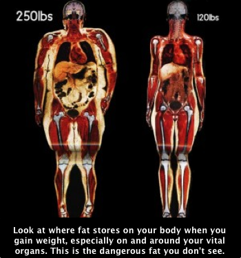 VO_Body Scan of Fat vs Average person.